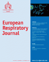 European Respiratory Journal: 28 (3)